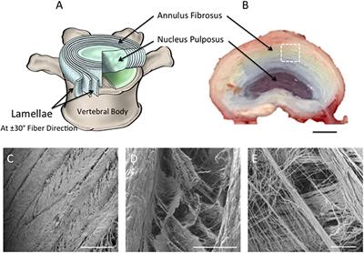 Tissue Engineering the Annulus Fibrosus Using 3D Rings of Electrospun PCL:PLLA Angle-Ply Nanofiber Sheets